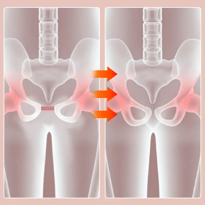 PeachFlex™ Pelvic & Leg Shaper